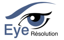 eye resolution